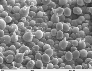 Scanning electron microscope image of budding mushroom spores. Agaricus bisporus
