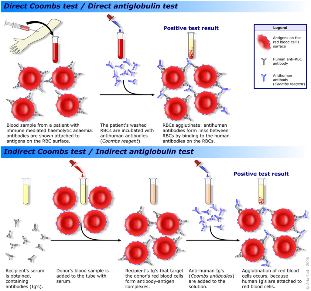 Difference Between Antibody and Antigen Test | Difference Between ...